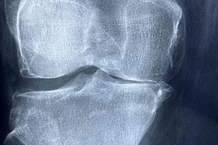 Villa El Inti - Suite 1